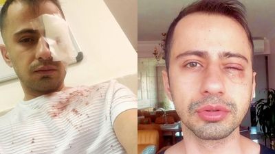 Repression in Iran: 'Whoever targeted my eye knew exactly who I was'