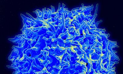 Australian discovery of change in ‘killer T cells’ could help fight against influenza