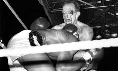 From Ali to the Bayonne Bleeder: a brief history of heavyweight boxing’s battle scars