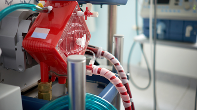 World Heart Day: Role played by ECMO in critical care