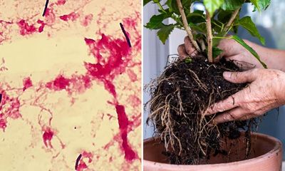 Australian gardener becomes first person to survive deadly flesh-eating bacteria