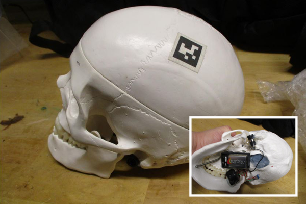 Model of human skull found in luggage shuts down airport security