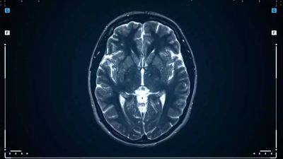 COVID infection triggered deadly brain disease in man?