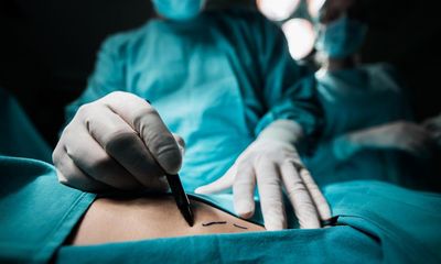 Cosmetic surgery needs better regulation to ensure patient safety