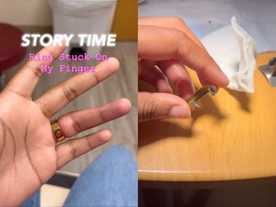Woman visits three emergency rooms to get ring off finger - only to buy the same one again