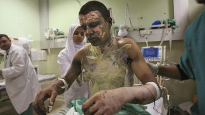 The legality of using white phosphorus