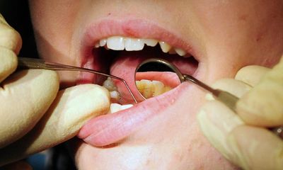 Complaints about poor NHS dental services rise 66% in five years