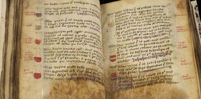 Modern medicine has its scientific roots in the Middle Ages − how the logic of vulture brain remedies and bloodletting lives on today