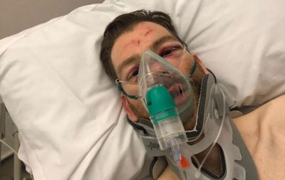 Giant facing legal claim of over £200,000 after bike collapse causes broken back