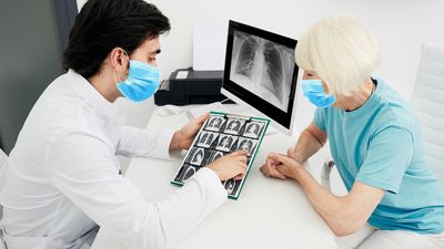 Millions more people need lung cancer screening, ACS says