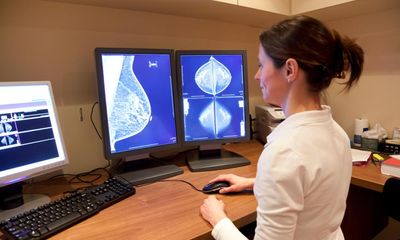 Share your reaction to women gaining access to cancer drug that halves the risk of breast cancer