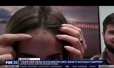 Florida woman bitten on head by nine-foot alligator