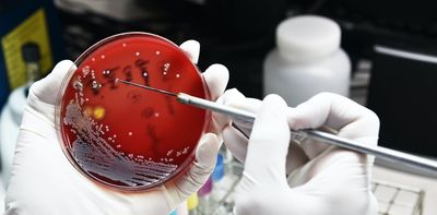 Antibiotic resistance: microbiologists turn to new technologies in the hunt for solutions – podcast