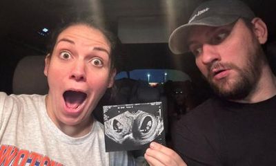 ‘Astounding’: Alabama woman with two uteruses is pregnant in both wombs