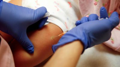 U.S. data underscore benefits of chickenpox vaccination