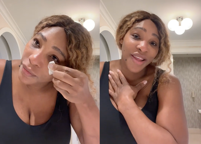 Serena Williams reveals she used breast milk to treat sunburn