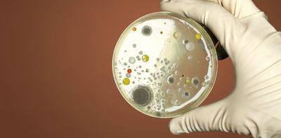 Antimicrobial resistance now hits lower-income countries the hardest, but superbugs are a global threat we must all fight