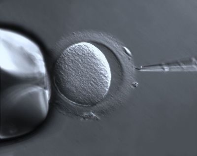 Call to Aid UK IVF Patients Urges Donation of Unused Embryos Amidst Research Setback