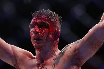UFC featherweight Darren Elkins undergoes surgery after snapping right leg in freak accident