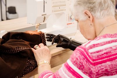 Woman Becomes Oldest Person In The World To Receive A Bionic Arm At 84