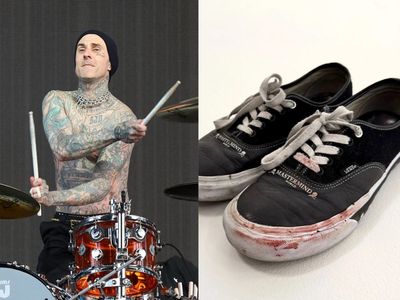 Travis Barker called ‘gross’ for selling his blood-stained sneakers