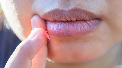Tips to lighten dark lips at home