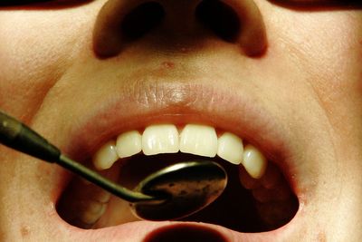 Woman sues dentist over five-hour surgery on 28 teeth