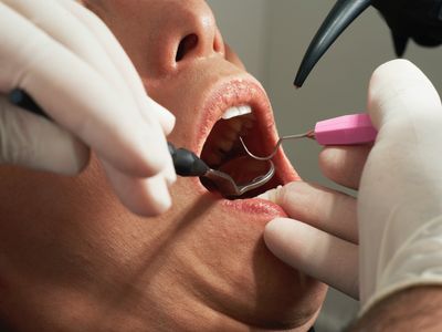 Dentist Sued for Negligence After Excessive Dental Procedures Lead to Disfigurement