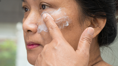 Melasma causes: How to get rid of dark spots and pigmentation