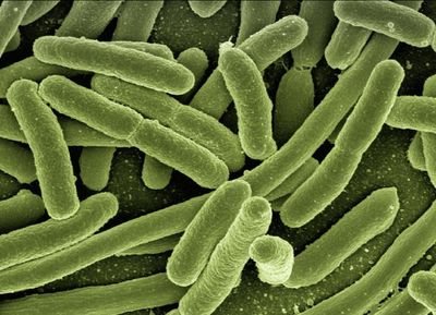 Scottish person dies in E. coli outbreak after 'contaminated cheese' warning