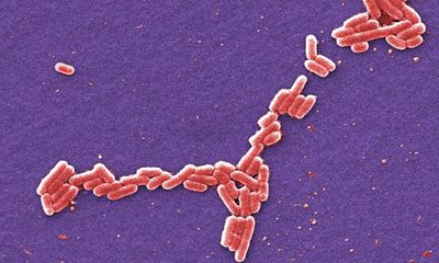 Person dies in Scotland after UK E coli outbreak, health officials say
