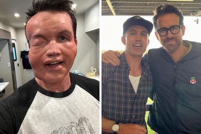 Rob McElhenney’s Fans Disturbed As Actor Shares New Year’s Eve Photo Of His “Swollen” Face
