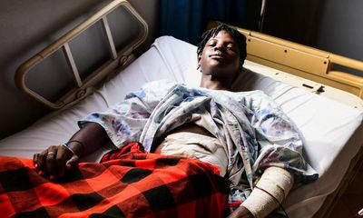 Ugandan LGBTQ+ activist in critical condition after brutal knife attack