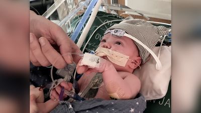 1st partial-heart transplant growing with baby 1 year later