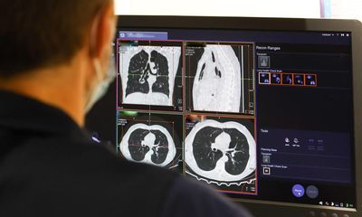 Settle NHS dispute or thousands with cancer could die early, say health chiefs