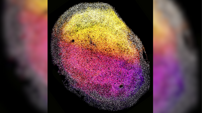 In a 1st, 'minibrains' grown from fetal brain tissue