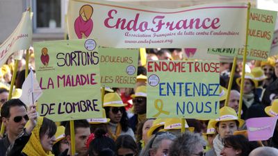 World-first endometriosis saliva test wins support of French health body