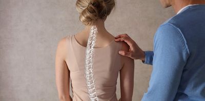 Breaking the curve: A call for comprehensive scoliosis awareness and care
