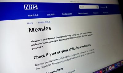 Measles in the UK: tell us how you have been affected by the outbreak