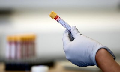 Blood test could revolutionise diagnosis of Alzheimer’s, experts say