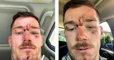 Police officers charged over incident involving Canberra Raiders star Tom Starling