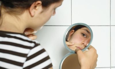 ‘It’s disturbing’: the rise in UK children wanting anti-ageing products