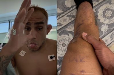 Tony Ferguson says he fought Paddy Pimblett with torn MCL at UFC 296, reveals recent surgery