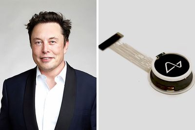 “That Is The Goal”: Elon Musk’s Neuralink Is Implanted In First-Ever Human