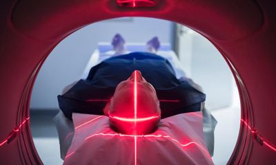 Next time your doctor orders a scan, know the benefits but don’t forget to ask about the harm