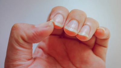 Fingernails can be home to 32 different types of bacteria; here's how to keep them clean