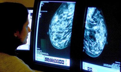 Surge in UK cancer patients going private revealed as King Charles starts treatment