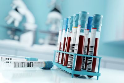 How to interpret a blood test