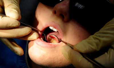 Tell us your experiences of getting access to an NHS dentist