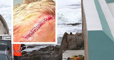 'I could have died': boy jumped off Newcastle baths wall, hit head